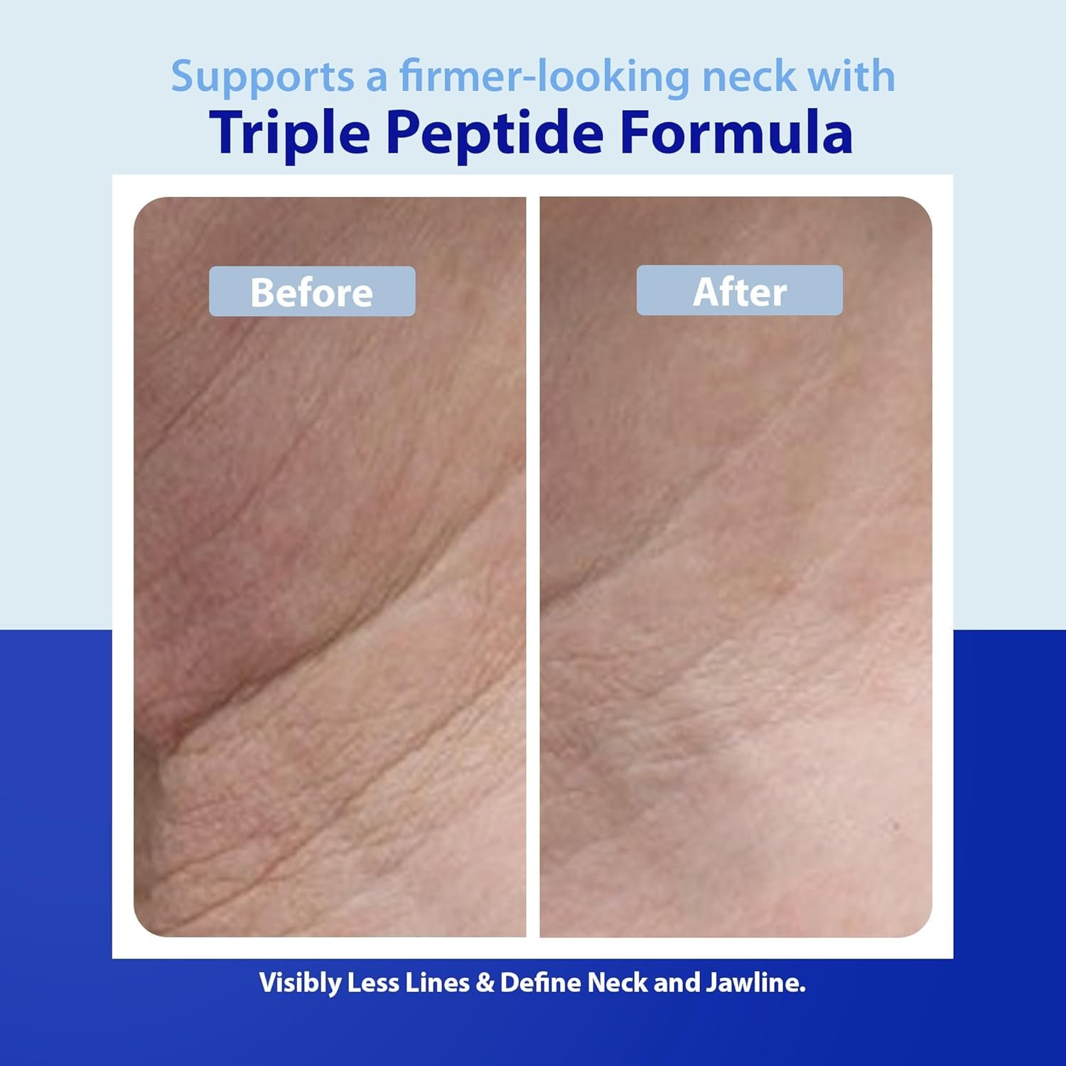 Dr. Denese Triple Strength Neck Wrinkle Smoother 4 oz – Firming Cream with Triple Amount of Peptides Compared to Industry Standards – Retinol & Hyaluronic Acid for Hydrating Power - Paraben Free - Image 4