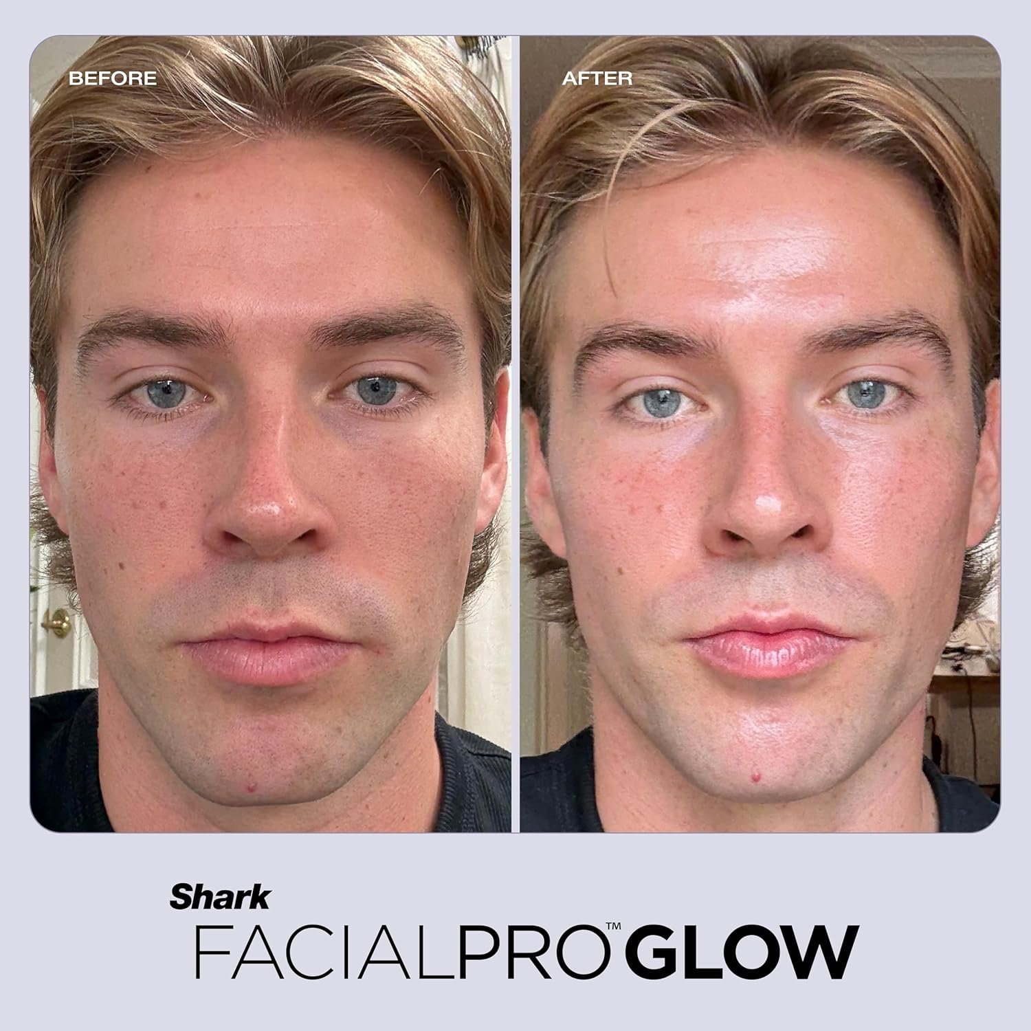 Shark FacialPro Glow at-Home Hydro-Powered Facial System with DePuffi Hot & Cold Therapy – Professional Spa Skincare Device for Pore Cleansing, Hydration, & Radiant Glow, Blue, FH320 - Image 13