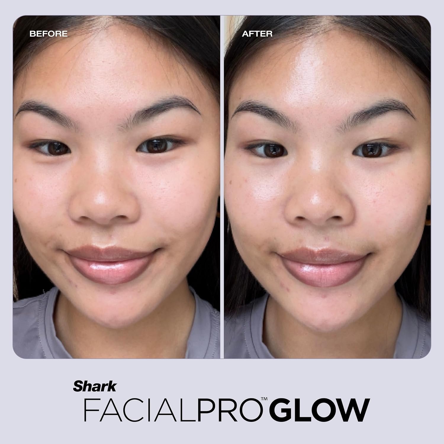 Shark FacialPro Glow at-Home Hydro-Powered Facial System with DePuffi Hot & Cold Therapy – Professional Spa Skincare Device for Pore Cleansing, Hydration, & Radiant Glow, Blue, FH320 - Image 12