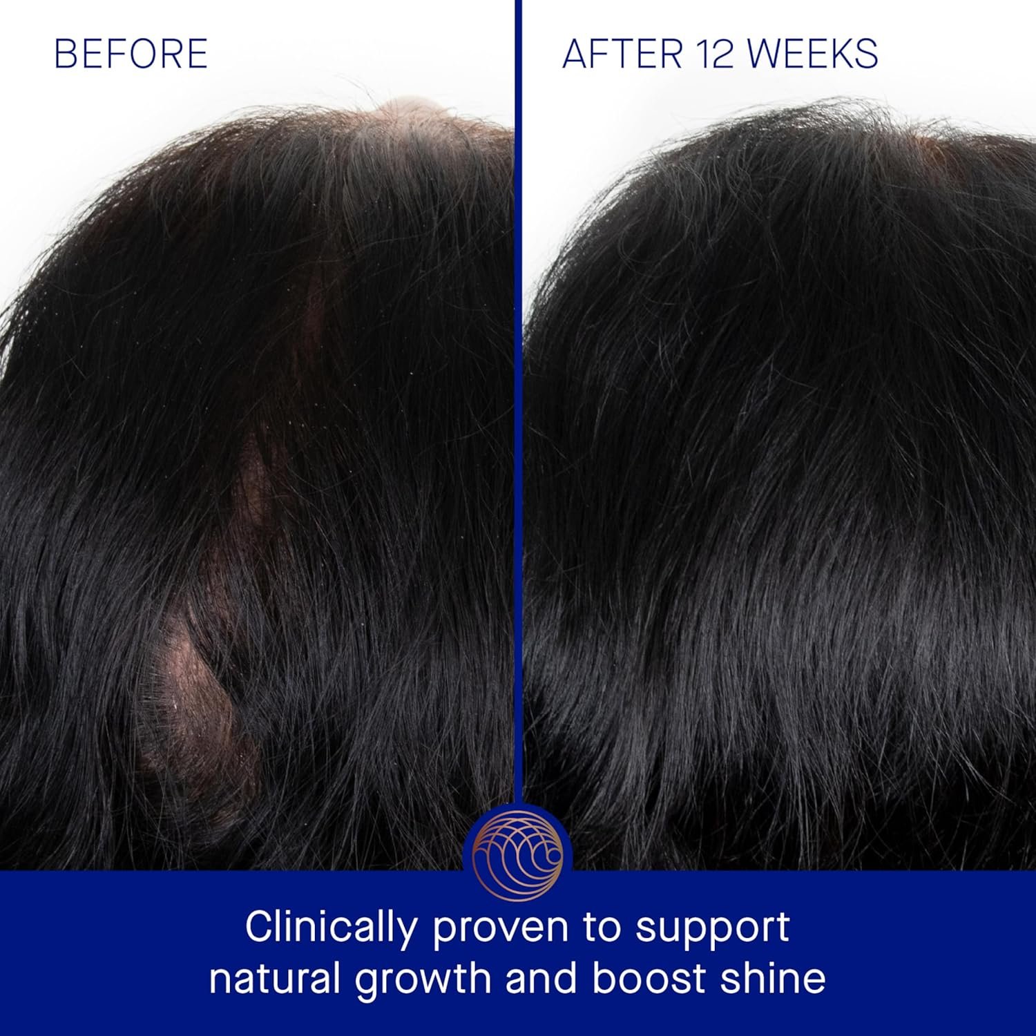 Augustinus Bader Women's The Scalp Treatment - Image 3